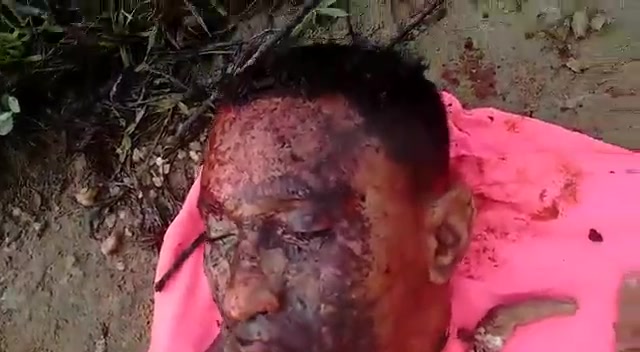 Dismembered Guy In Brazil