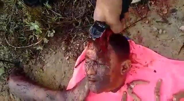 Dismembered Guy In Brazil