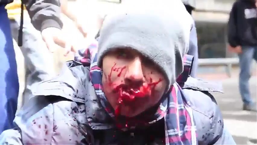 Protester got shot in the mouth by police.