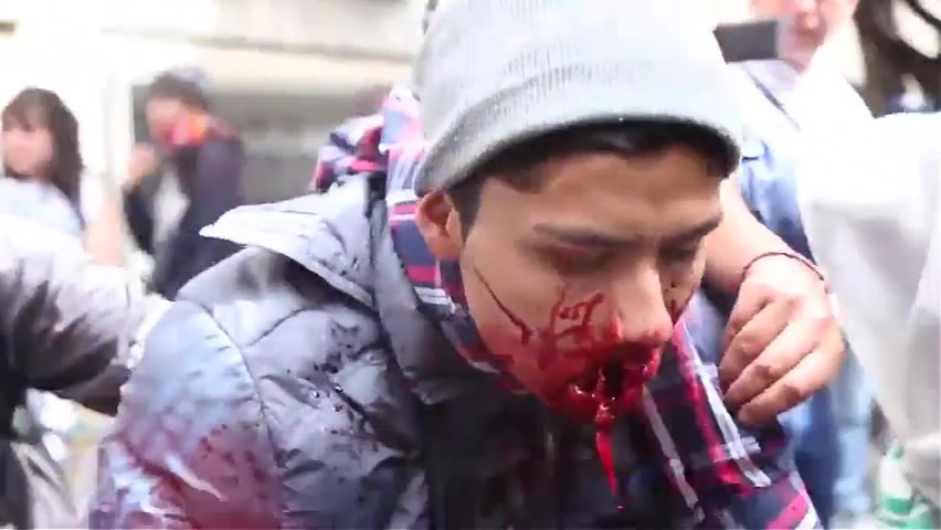 Protester got shot in the mouth by police.