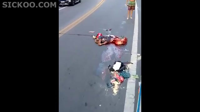 Mangled  Body After Motorcycle Accident