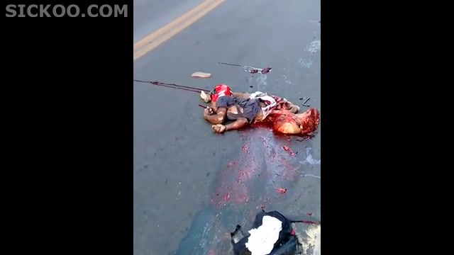 Mangled  Body After Motorcycle Accident