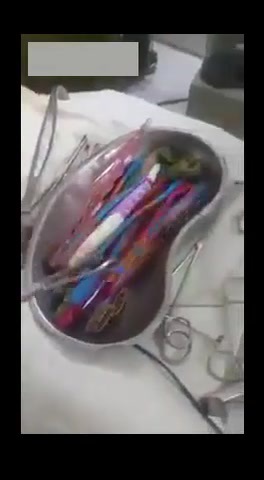 Toothbrush Collection in Stomach