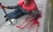 Brazilian thief with hand chopped off by machete