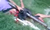 Guy alive after train accident ripped in half