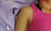 Young woman stabbed in forehead