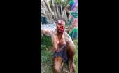 Man Survived Bear Attack