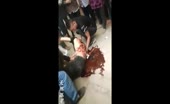 Aftermath of Machete Fight In China