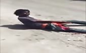 Horrible Bike accident in Jamaica one Leg chopped