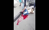 Guy gets his leg chopped off in Bike accident