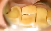 Nasty Yellow Teeths