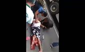 Woman leg crushed in accident