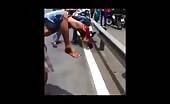 Man leg is totally smashed in Accident