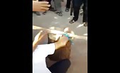 Two Guys get their Hands Chopped Off