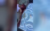 All injured man spitting blood when shot