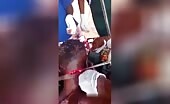 Man with different injuries in the wake of being assaulted with a cleaver ?