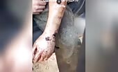Russian soldier along with maggots in his arm