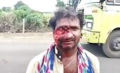 An inebriated indian motorcyclist along with his skin disfigured beyon