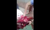 A group participant had his throat slice and also his tummy opened -