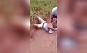 Rest, your lower leg is fucked anyhow full video recordings mu