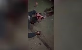 Mutilated physical body of a guy that dropped coming from a bike uncenso