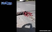 Guy Turned Into A Mess After Being Run Over By A Truck