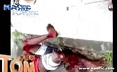 Man Screaming In Pain With His Leg Shredded In Half