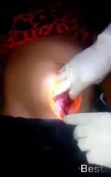 Autopsy Removal Of Dead Fetus from Dead Woman - on horriblevideos.com