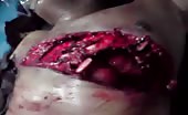 Visible Man Heart Beating through severed chest