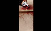 Bloody Mess After Being Shot In Head 