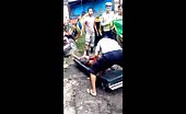 Body Ripped To Pieces By A Truck