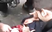 Civilian Shot In The Head By Police