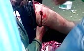 Syria War - A Surgery In A Field Clinic