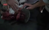 A Child Uttering His Last Breath (Graphic Content)