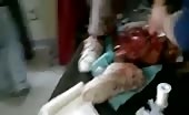 Syrian Man Lower Abdomen Mangled