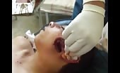 Young Boy With Brutal Wound On Face