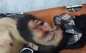 Man With Wound In The Chest Last Breathing