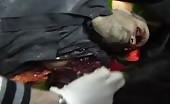 Man Dead With Guts Squished Out