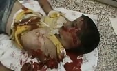 Video Of A Dead Child After Bombing (Graphic Content)
