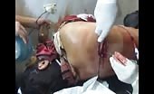 Treating And Stitching A Wound Caused By Shelling