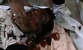Young Boy Brutally Killed By Syrian Army 
