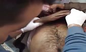 Man Gets His Arm Destroyed By Mortar Shelling