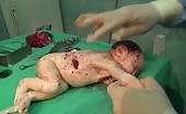 Syrian Army Kills The Embryos Before Seeing The Light 