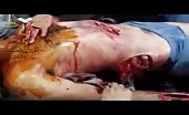 Severely Wounded Man  