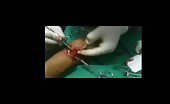 Treating A Wounded Hand With A Gunshot