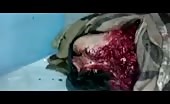 Man Completely Mangled By Mortar Shelling