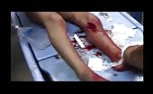 Young Kid With Deep Wound In Leg