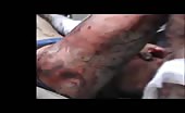 Badly Wounded Man Agonizing In Pain.