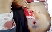 Man Killed By Syrian Sniper