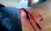 Man Brutally Wounded